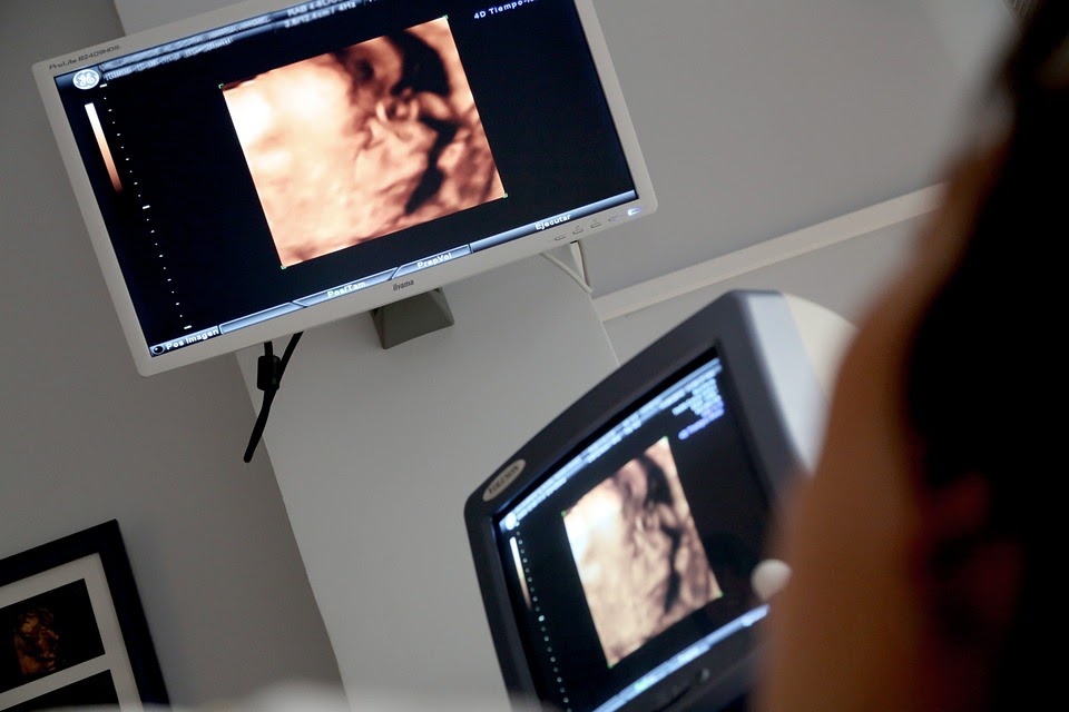 surrogate ultrasound